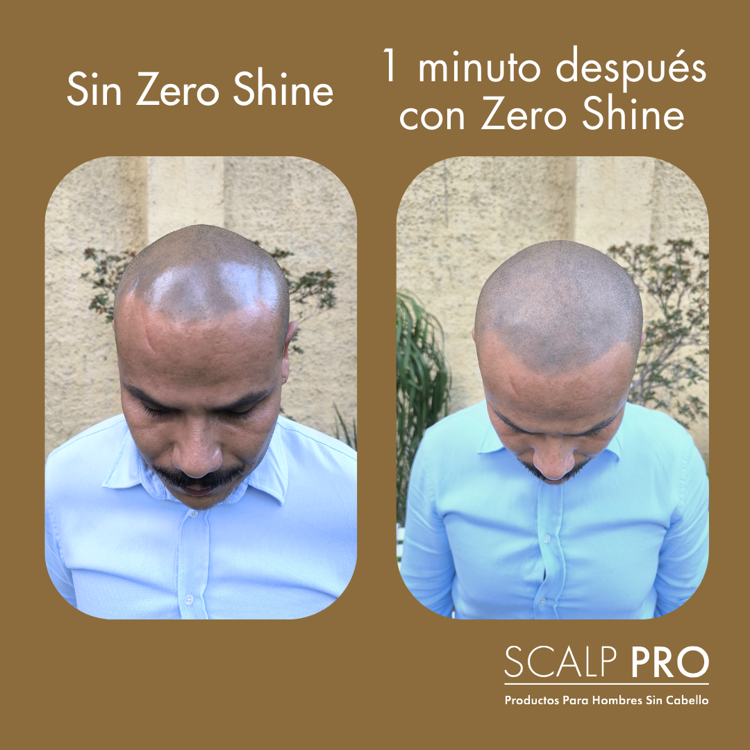 1 Zero Shine: Elimina el Brillo y Protege tu Cabeza del Sol Al Instante.