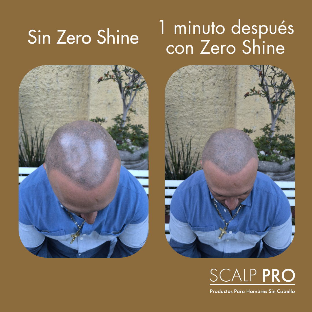 1 Zero Shine: Elimina el Brillo y Protege tu Cabeza del Sol Al Instante.