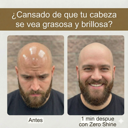 Elimina la Grasa de tu Cabeza y Potencia el Efecto Antibrillo de Zero Shine.