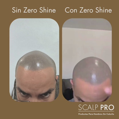 1 Zero Shine: Elimina el Brillo y Protege tu Cabeza del Sol Al Instante.