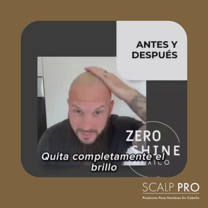 1 Zero Shine: Elimina el Brillo y Protege tu Cabeza del Sol Al Instante.